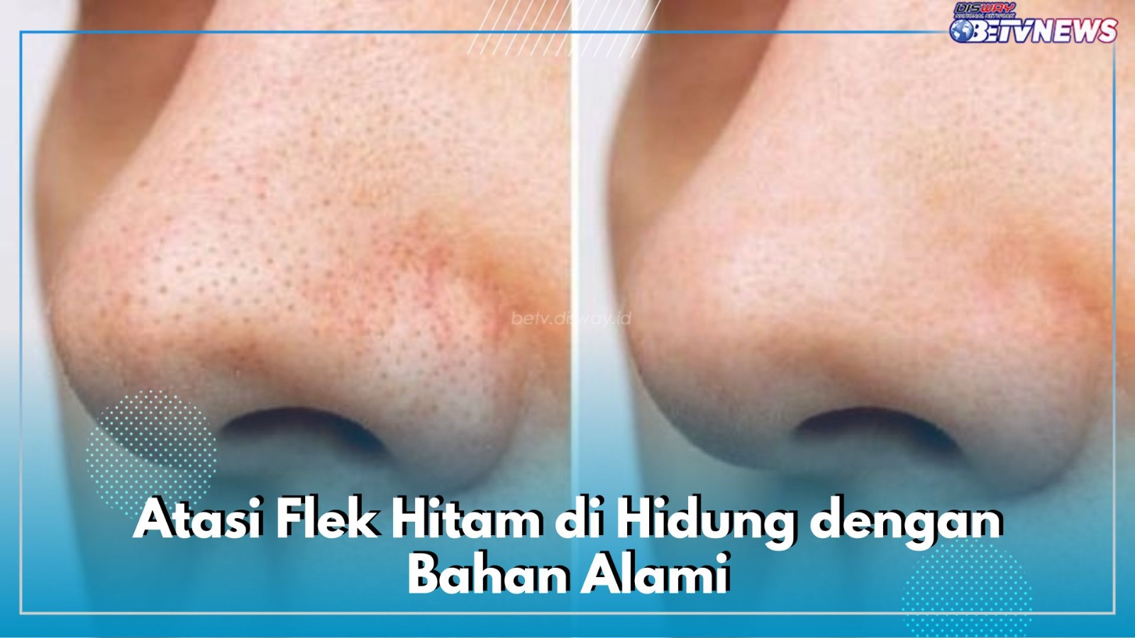 7 Cara Efektif Menghilangkan Flek Hitam di Hidung dengan Bahan Alami