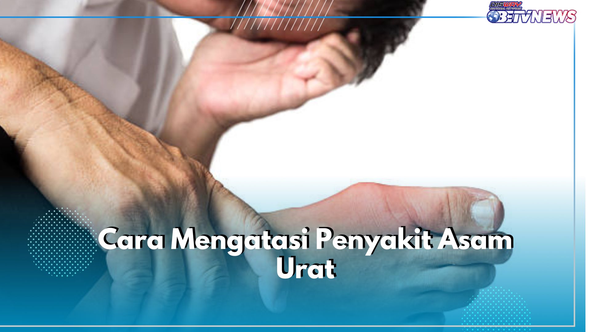 Yuk, Pahami dengan Teliti Cara Mengatasi Asam Urat Tanpa Obat, Terbukti Ampuh!