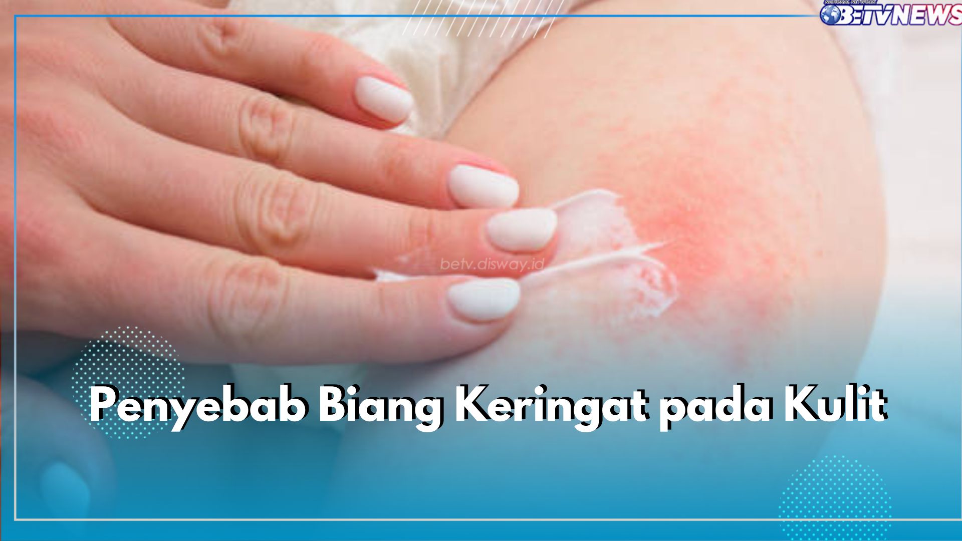 Bahan Pakaian Bisa Bikin Biang Keringat, Simak 5 Penyebab Lainnya di Sini!