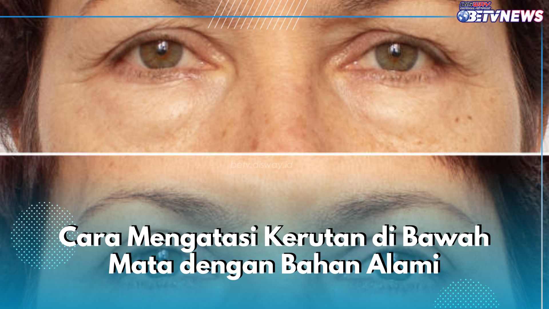 Kerutan di Bawah Mata Hempas dengan Sederet Bahan Alami Ini, Salah Satunya Minyak Zaitun