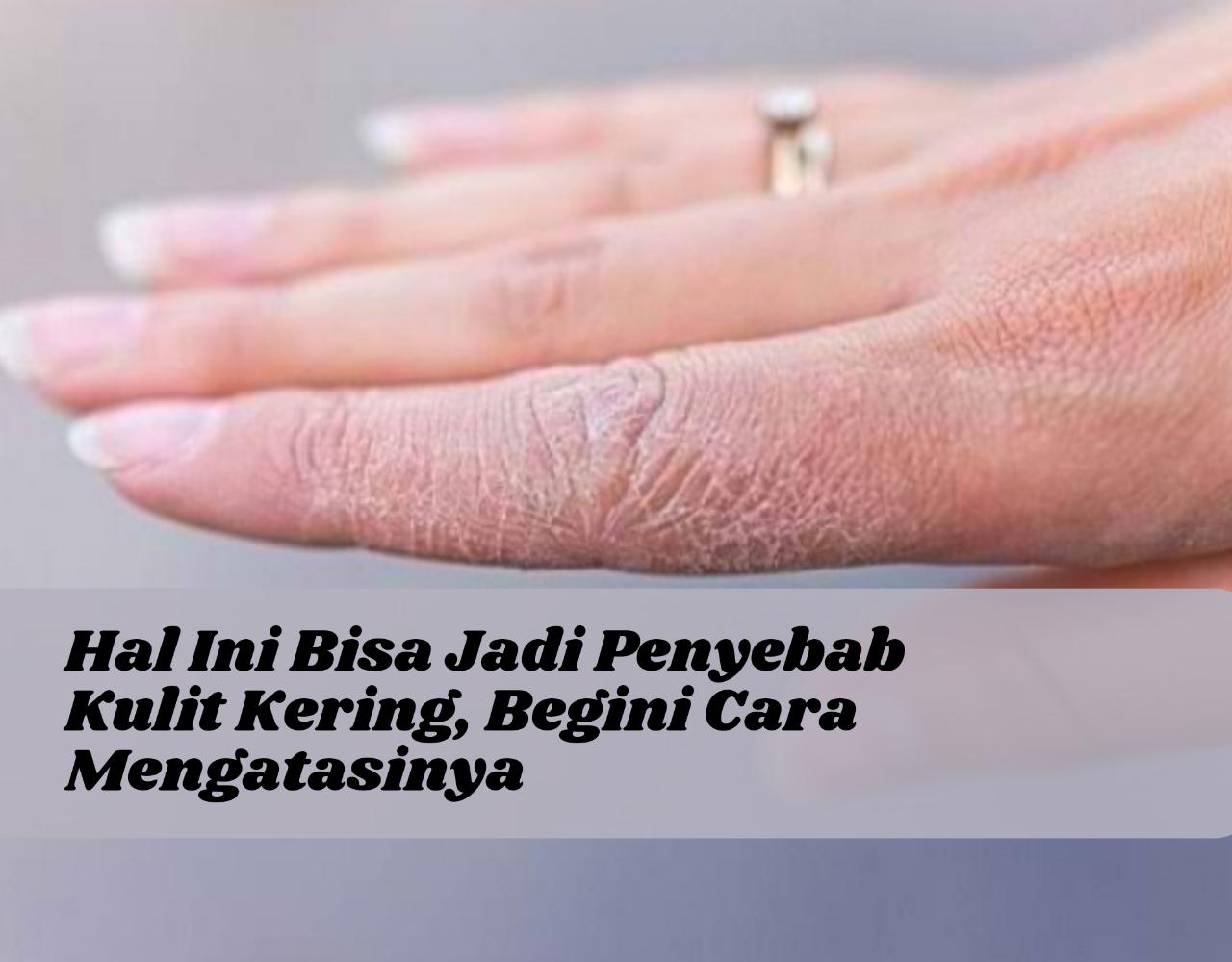 Hati-hati! 7 Hal Ini Bisa Jadi Bikin Kulit Kering, Intip Cara Mengatasinya di Sini