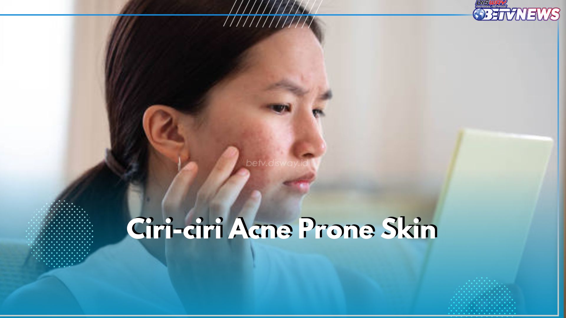 Ciri-Ciri Acne Prone Skin yang Perlu Kamu Ketahui, Punyamu Termasuk?