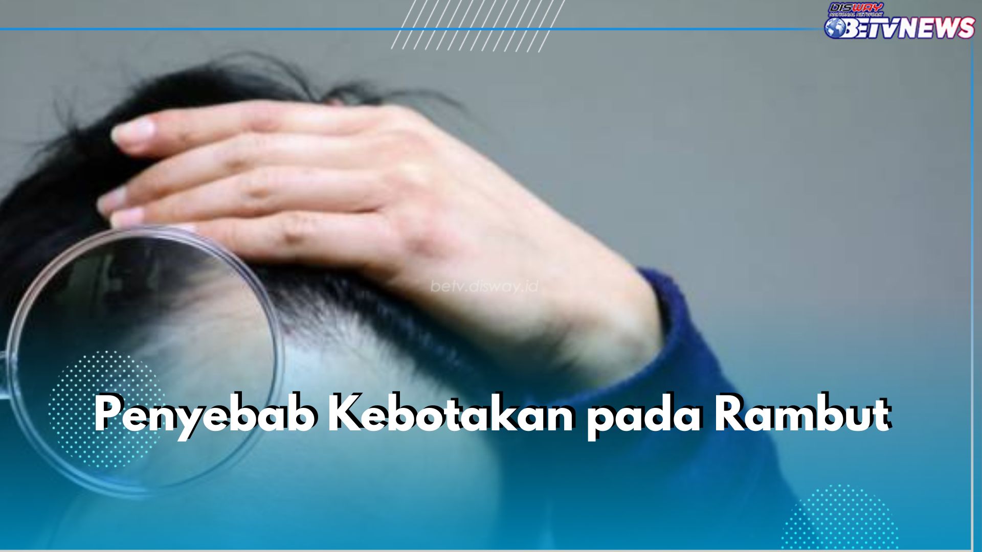 Kenali 7 Penyebab Kebotakan pada Rambut Ini,  Salah Satunya Stres