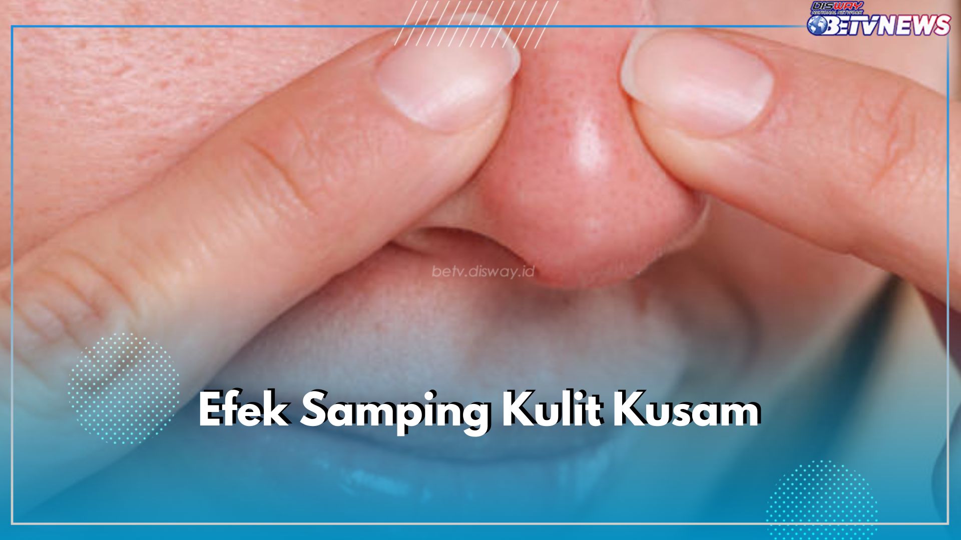 Kering dan Bertektur, Ini 7 Efek Samping Kulit Kusam Jika Tidak Dicegah