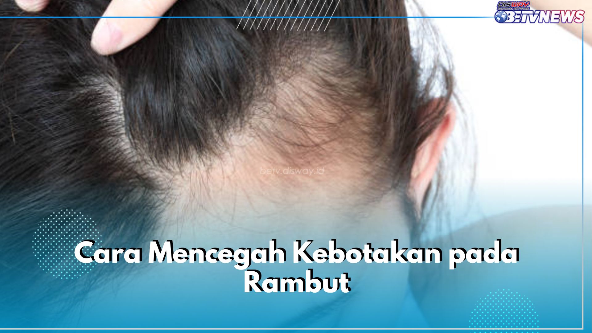 Jangan Ditunda! Ini 6 Cara Cegah Kebotakan pada Rambut, Salah Satunya Kelola Stres