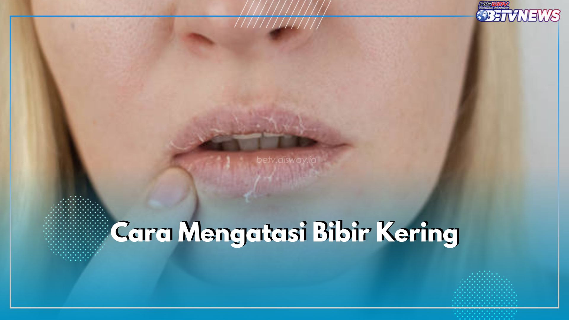 5 Cara Sederhana untuk Atasi Bibir Kering, Salah Satunya Rutin Gunakan Lip Balm