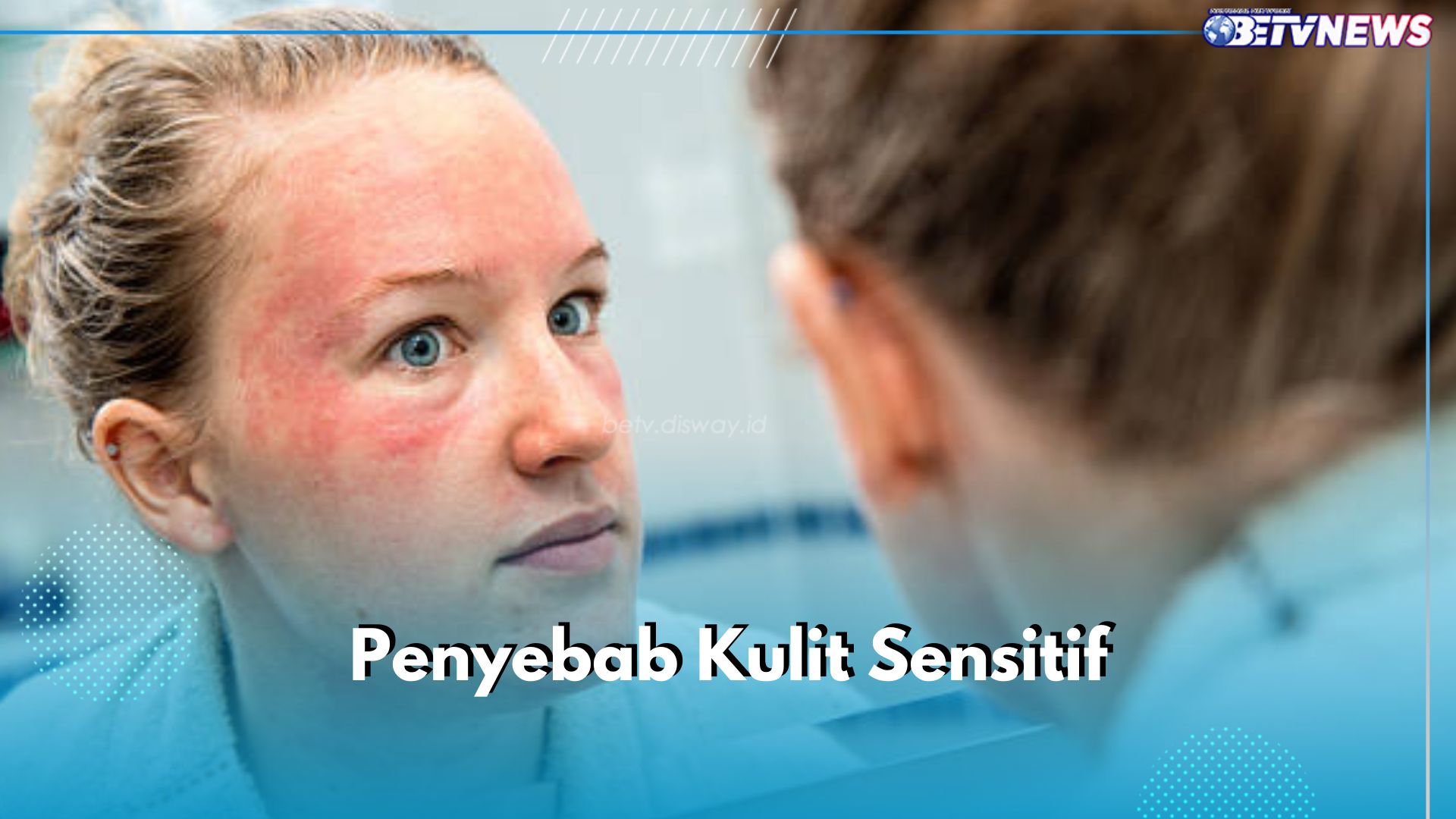 6 Penyebab Ini Bisa Bikin Kulit Jadi Sensitif, Salah Satunya Penggunaan Skincare yang Tidak Cocok