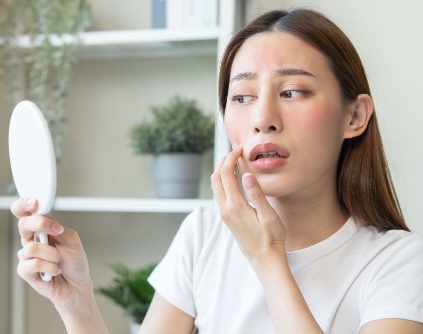 Cara Mengatasi Kulit Wajah Kering, Kulit Tetap Lembap dan Cocok untuk Sehari-hari