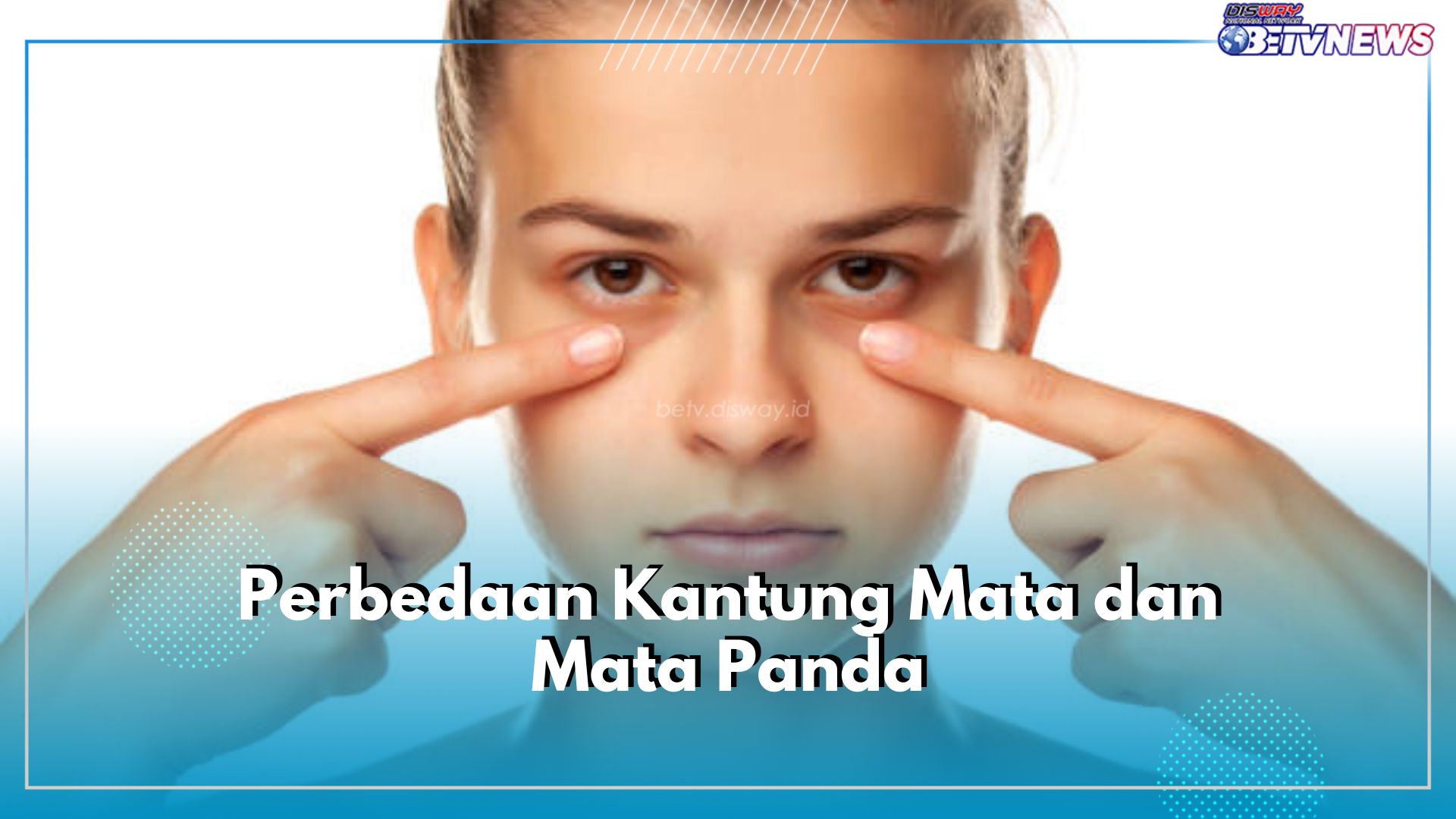 Kerap Disamakan, Ini 4 Perbedaan Kantung Mata dan Mata Panda yang Perlu Kamu Ketahui, Apa Saja>