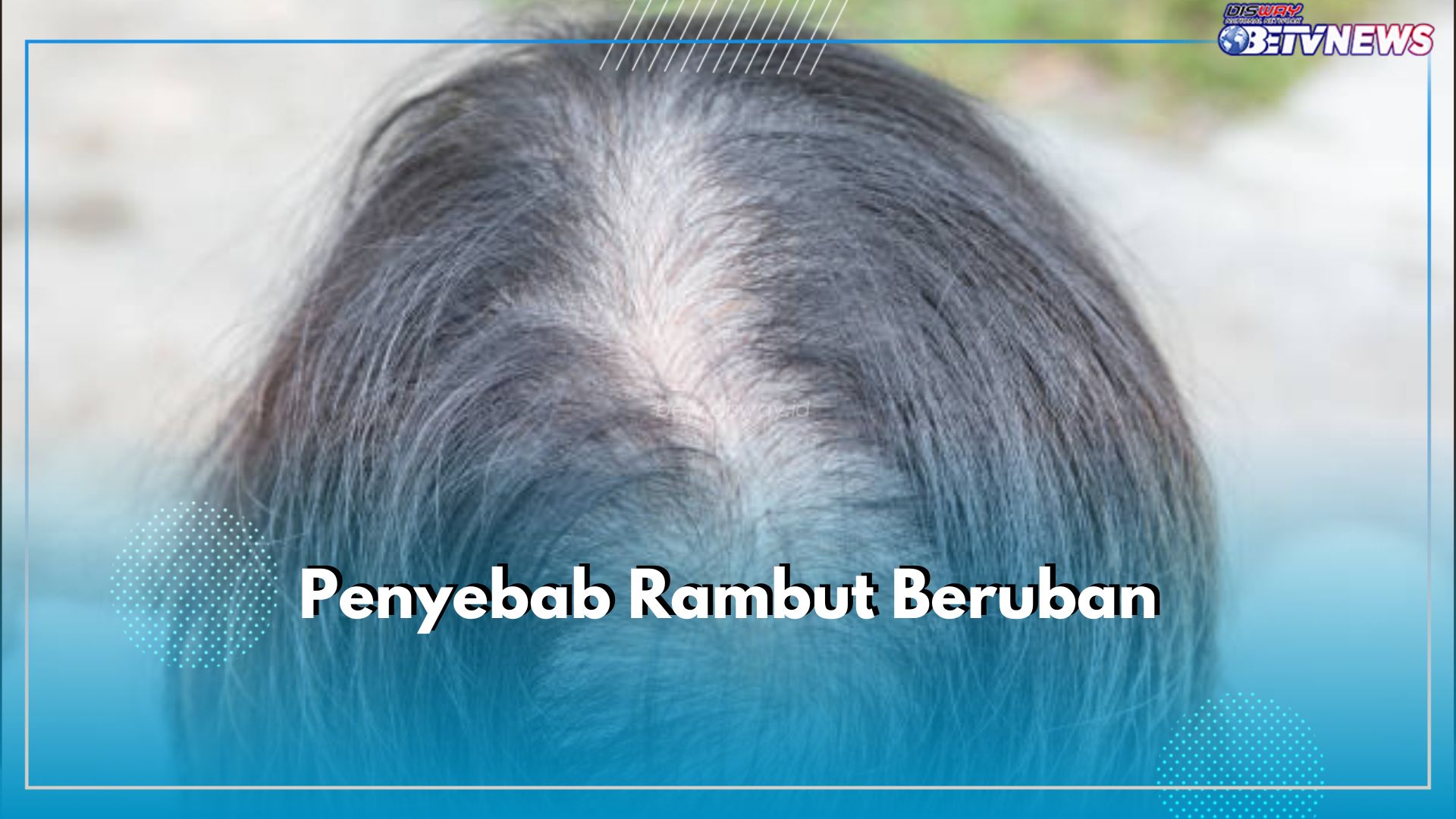 6 Penyebab Rambut Beruban, Faktor Usia Bukan Satu-satunya