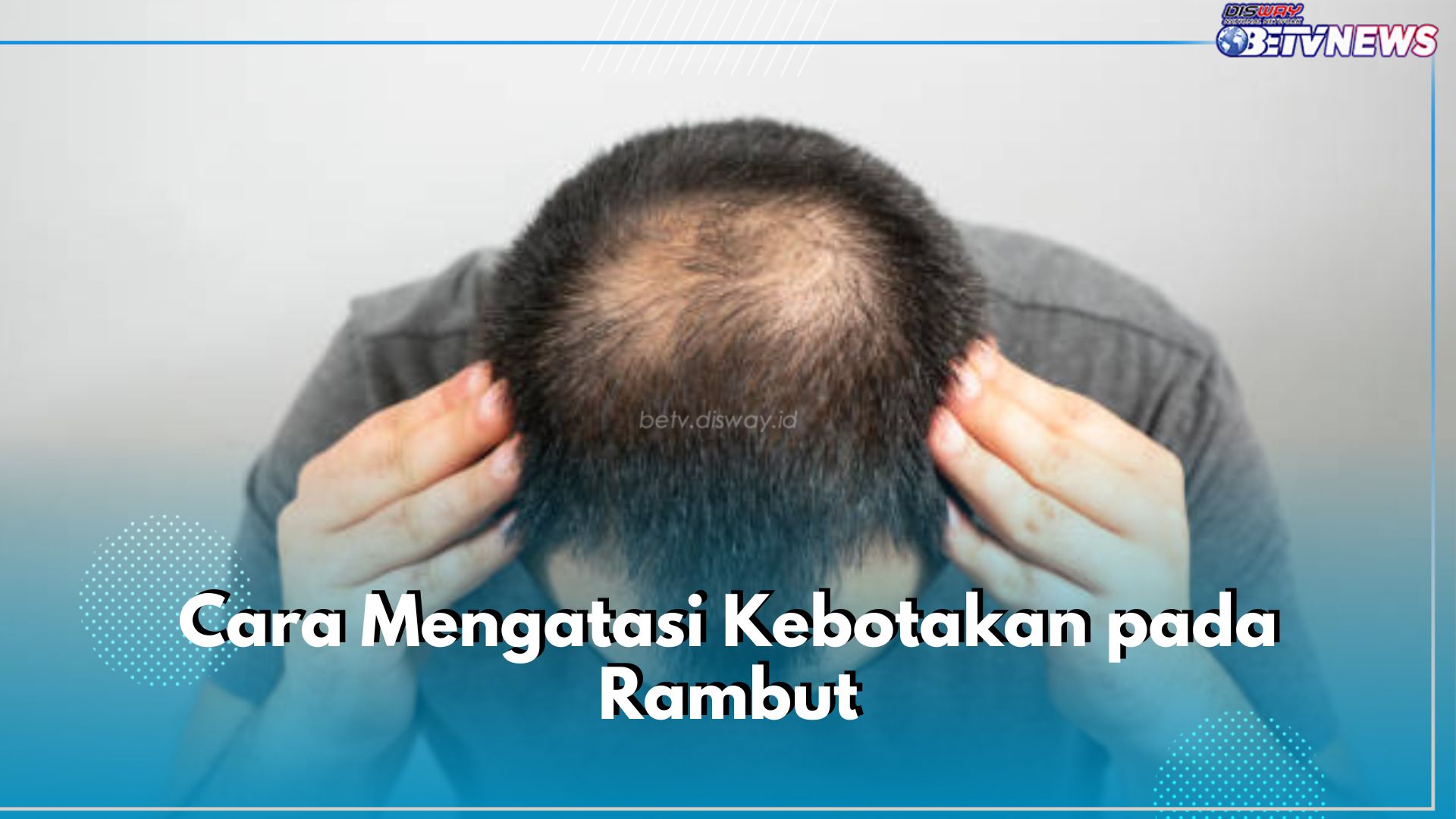 Ini 6 Cara Mudah Atasi Kebotakan pada Rambut, Nomor 3 Paling Penting