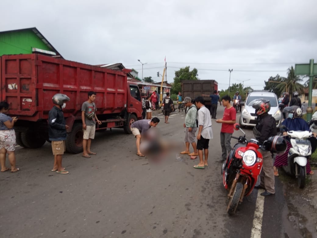 Tabrak Lari, Warga Tengah Padang Alami Patah Tangan