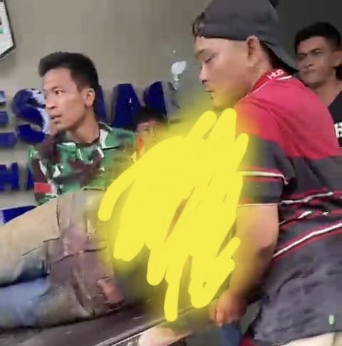 Security PT. RAA Bengkulu Tengah Dibacok, Luka Parah di Kepala