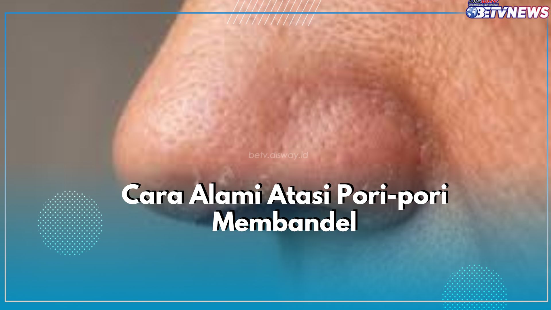 Terapkan Cara Alami Ini untuk Atasi Pori-pori di Wajah, Salah Satunya Gel Lidah Buaya
