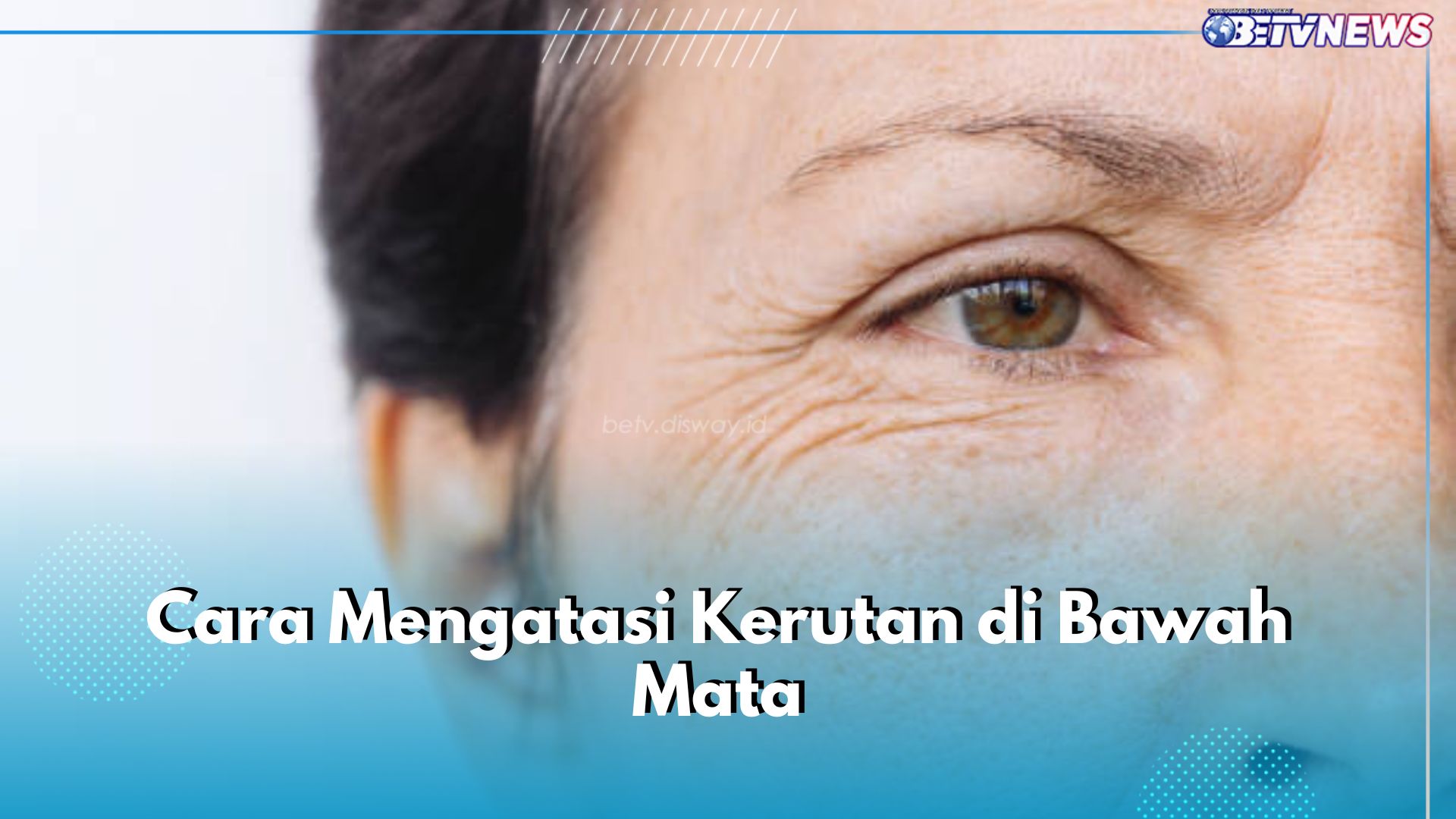 Jangan Dibiarkan! Ini 6 Cara Atasi Kerutan di Bawah Mata dengan Bahan Alami, Coba Gunakan Minyak Kelapa