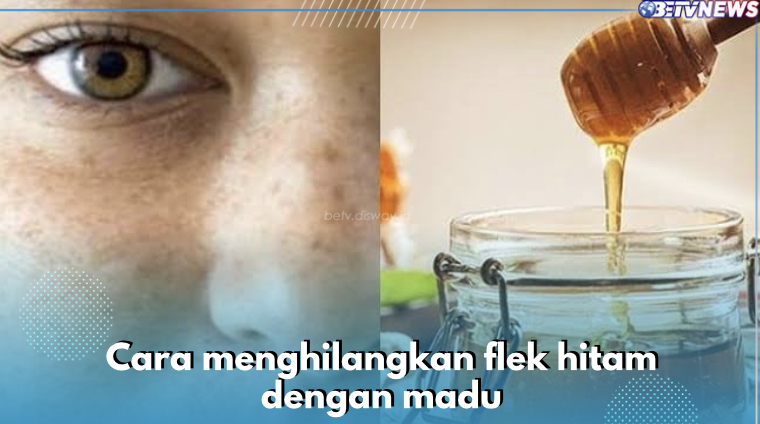 5 Cara Tumpas Flek Hitam Menahun dengan Madu, Dijamin Efektif Bikin Kulit Glowing