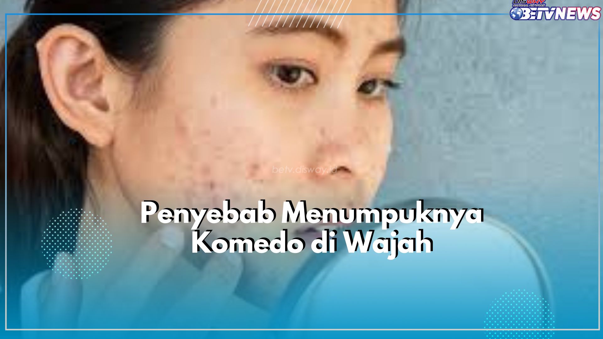 Ada Sebab Tentu Ada Akibat! Cek Penyebab Menumpuknya Komedo Diwajah Hingga Berakibat Tumbuhnya Jerawat