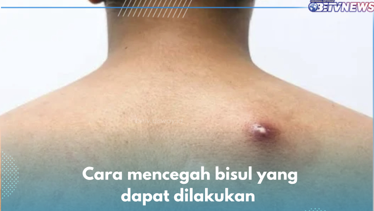 Ini 5 Cara Mencegah Bisul, Salah Satunya Ganti Pakaian Setiap Hari