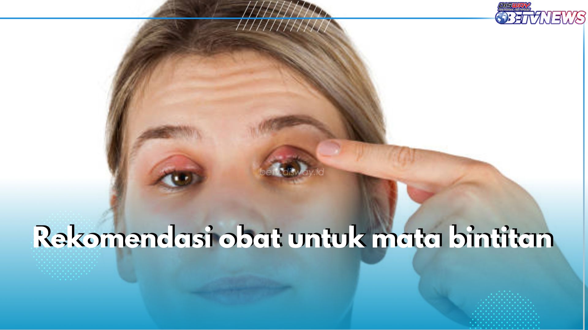 5 Rekomendasi Obat untuk Mata Bintitan, Efektif dan Ampuh!