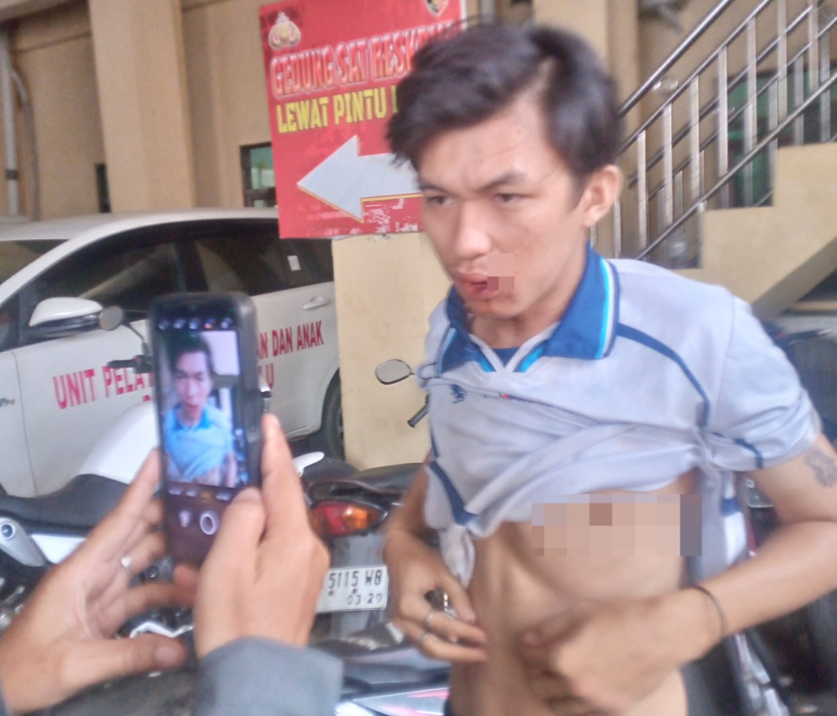 Diduga Salah Sasaran, Pemuda Sawah Lebar Dikeroyok Oknum TNI dan Polri