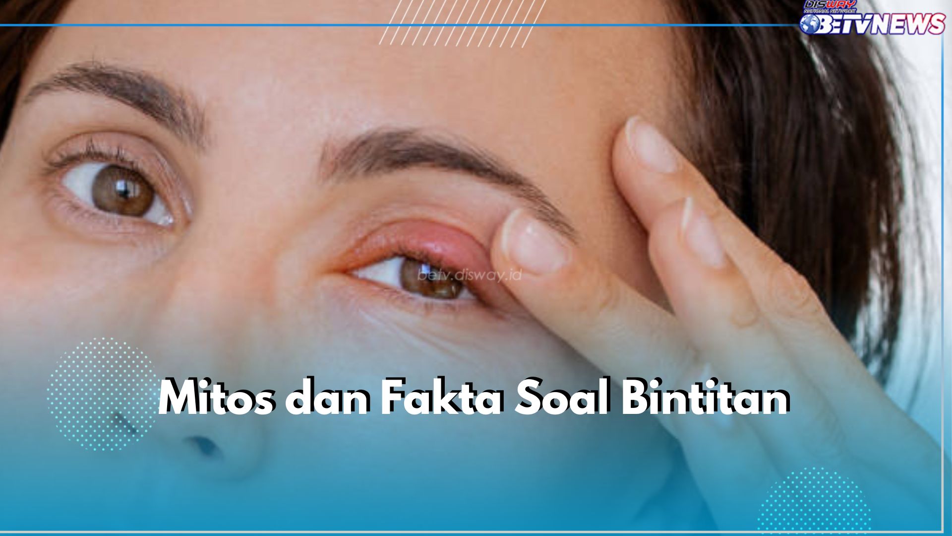 Benarkah Bintitan Karena Suka Ngintip? Cek Mitos dan Fakta Soal Bintitan Ini dan Ketahui Jawabannya!