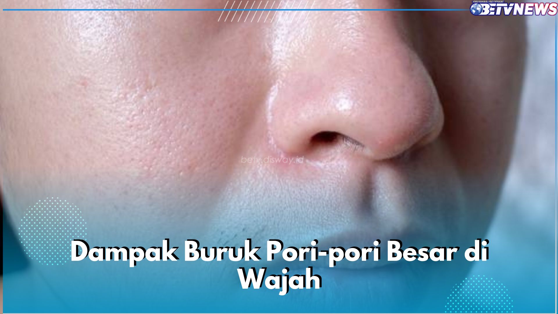 5 Dampak Buruk Pori-Pori Besar di Wajah, Bikin Kulit Rentan Berjerawat