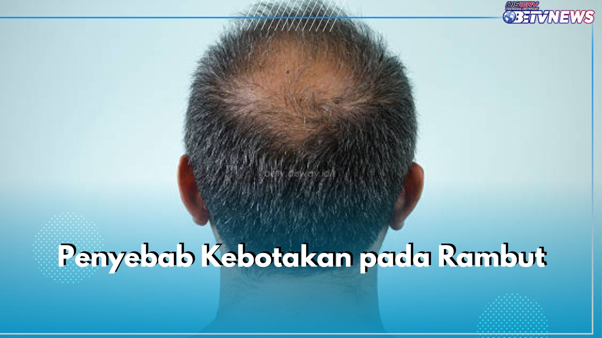 Ini 7 Penyebab Kebotakan pada Rambut yanh Perlu Kamu Ketahui, Ada Faktor Genetik hingga Kebiasaan Merokok