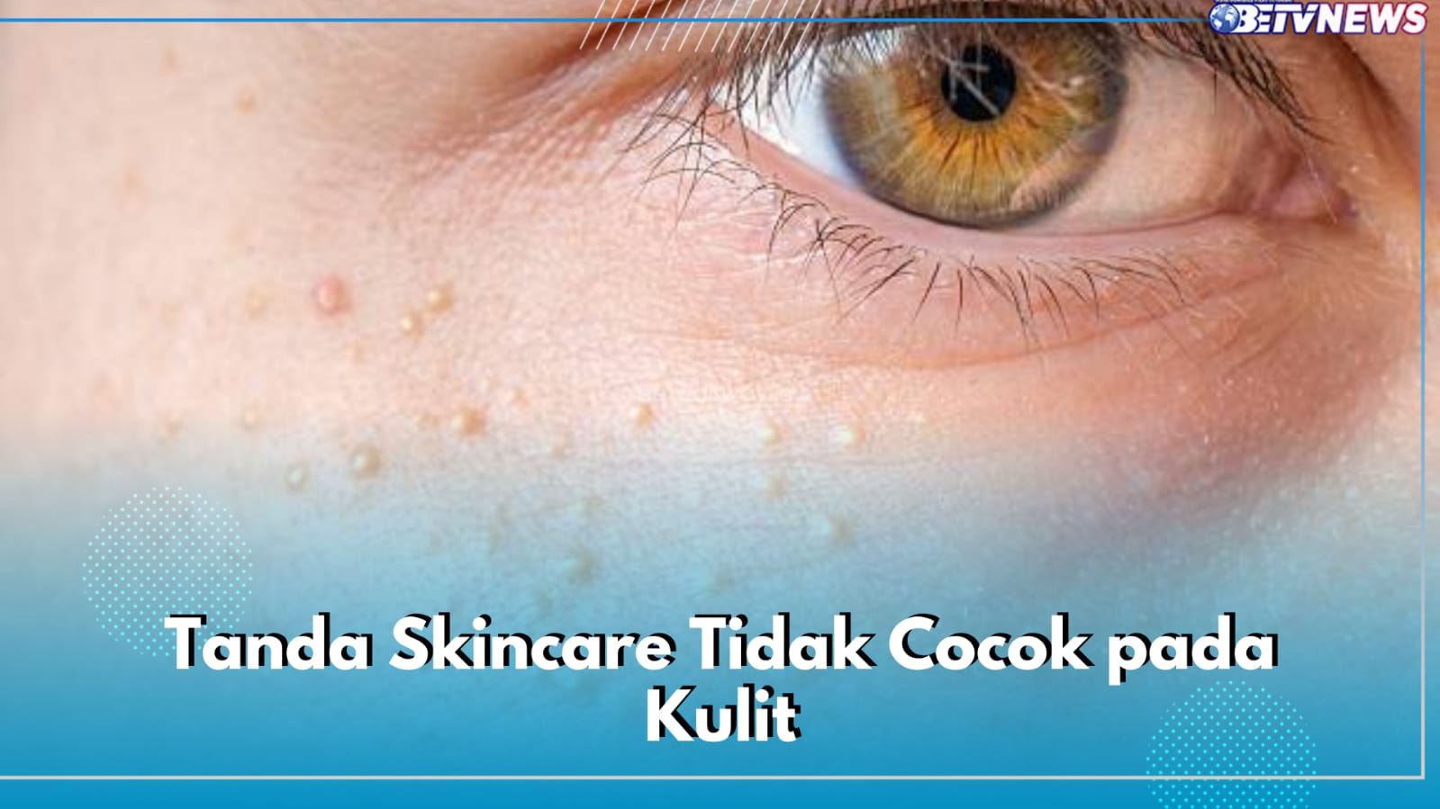 Jangan Diteruskan! Ini Tanda Produk Skincare Tidak Cocok dengan Kulitmu