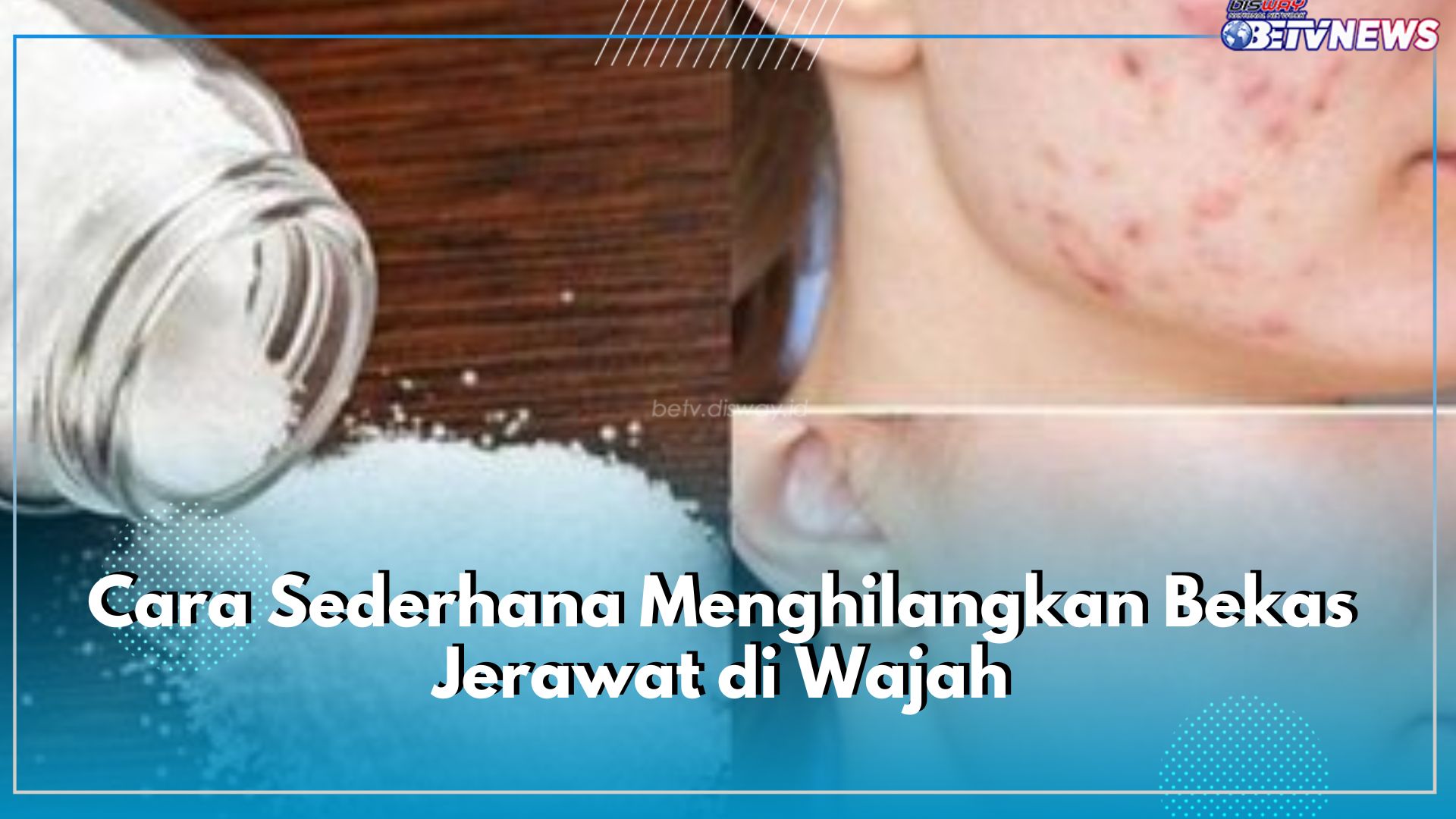 Cara Sederhana Menghilangkan Bekas Jerawat di Wajah, Gunakan 7 Bahan yang Ada di Dapur, Cek Daftarnya di Sini