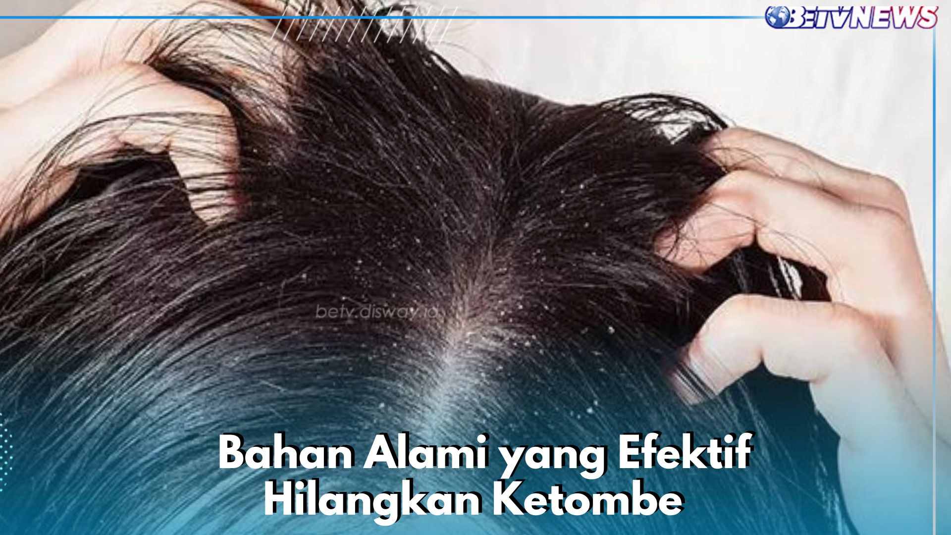 6 Bahan Alami Ini Efektif Hilangkan Ketombe, Rambut Sehat dan Gatal di Kulit Kepala Auto Minggat