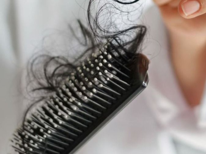 Ini Penyebab Rambut Sering Rontok yang Perlu Diketahui, Jangan Diabaikan