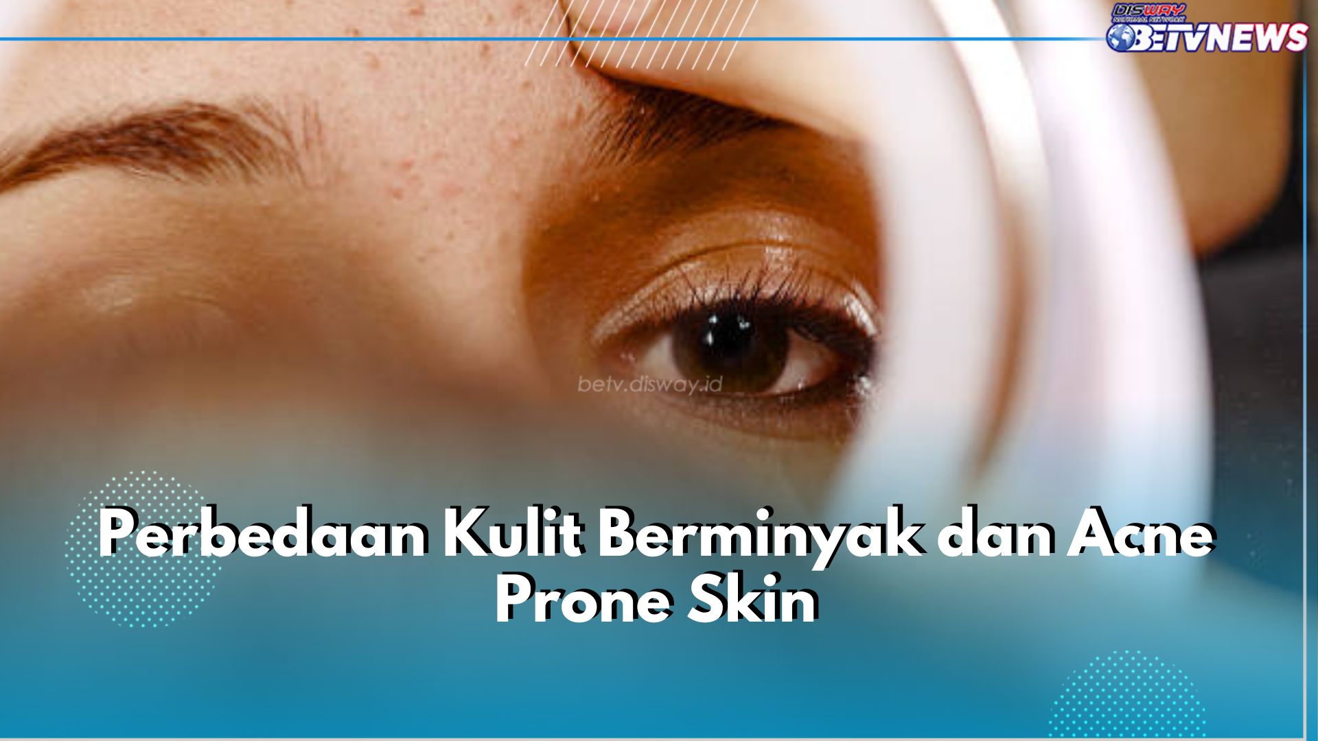 Tidak Sama, Ini Perbedaan 6 Kulit Berminyak dan Acne Prone Skin yang Perlu Kamu Ketahui