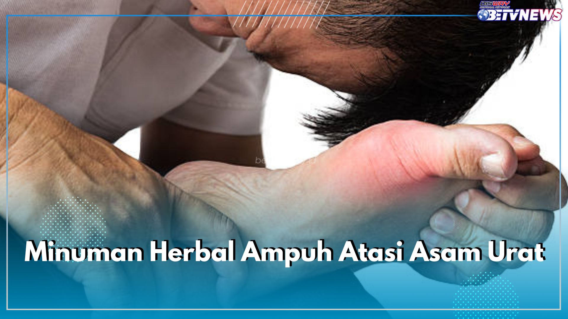 Asam Urat Coba Atasi dengan Ragam Minuman Herbal Ini, Apa Saja? Cek di Sini Daftarnya