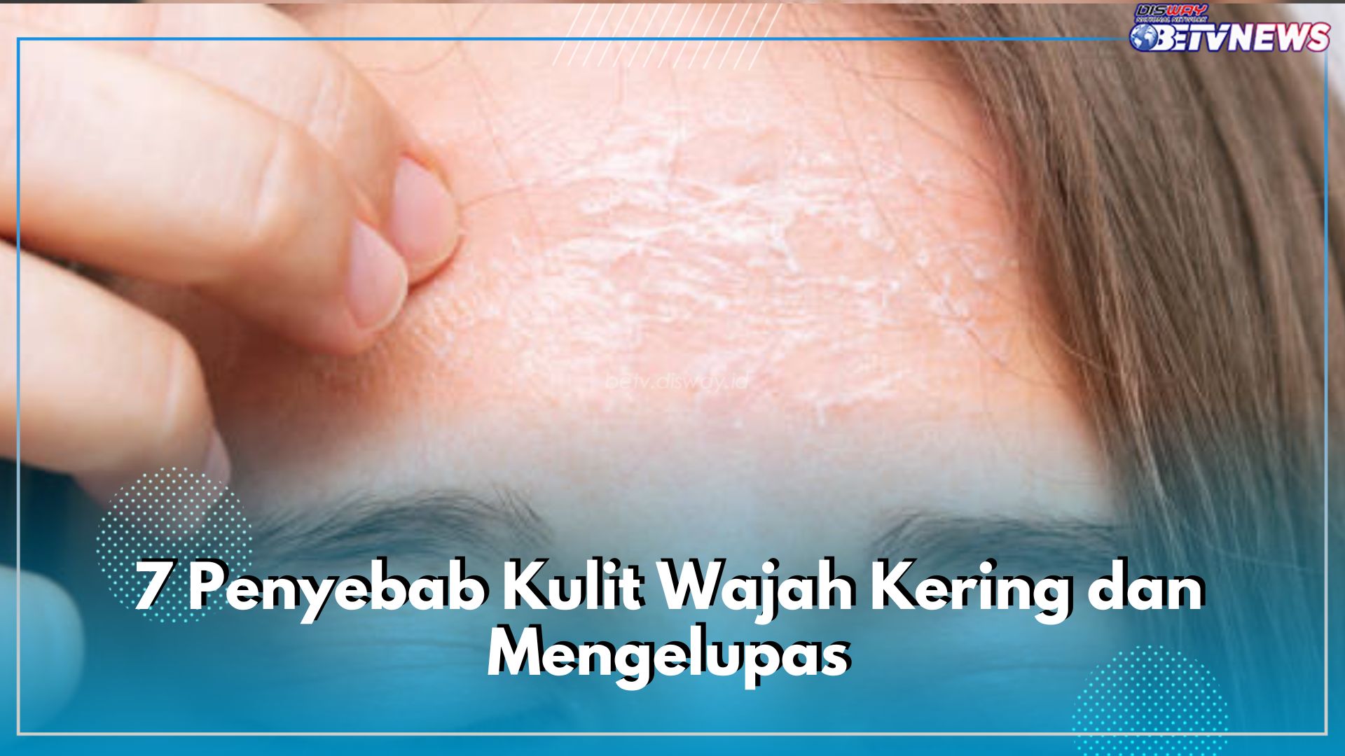 7 Penyebab Kulit Wajah Kering dan Mengelupas, Salah Satunya Mencuci Muka dengan Air Hangat, Jangan Lagi!