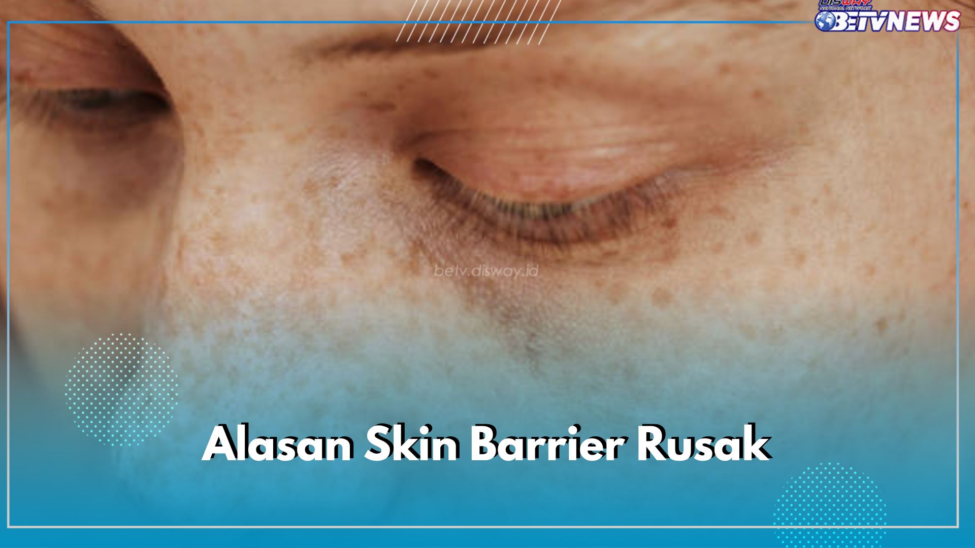 Skin Barrier di Wajah Bisa Rusak Karena 5 Hal Ini, Cek di Sini Alasannya