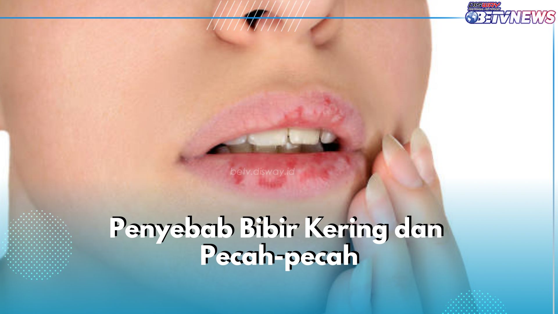 6 Penyebab Bibir Kering dan Pecah-pecah yang Sering Tidak Disadari, Apa Saja?