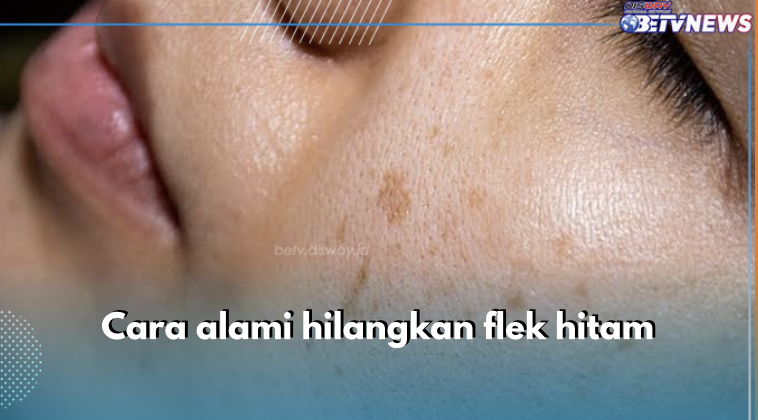 Ini 5 Cara Alami Tumpas Flek Hitam di Wajah, Pakai Madu Termasuk Salah Satunya