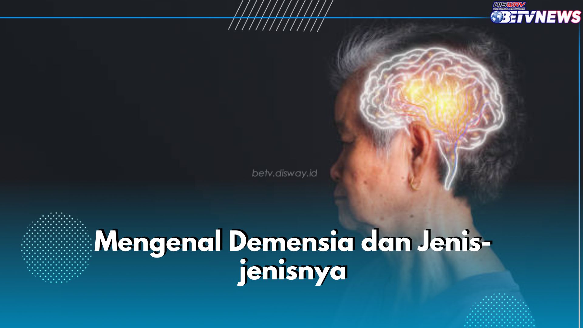 Mengenal Demensia, Gangguan Otak yang Kerap Dialami Kelompok Lanjut Usia, Ini Jenisnya