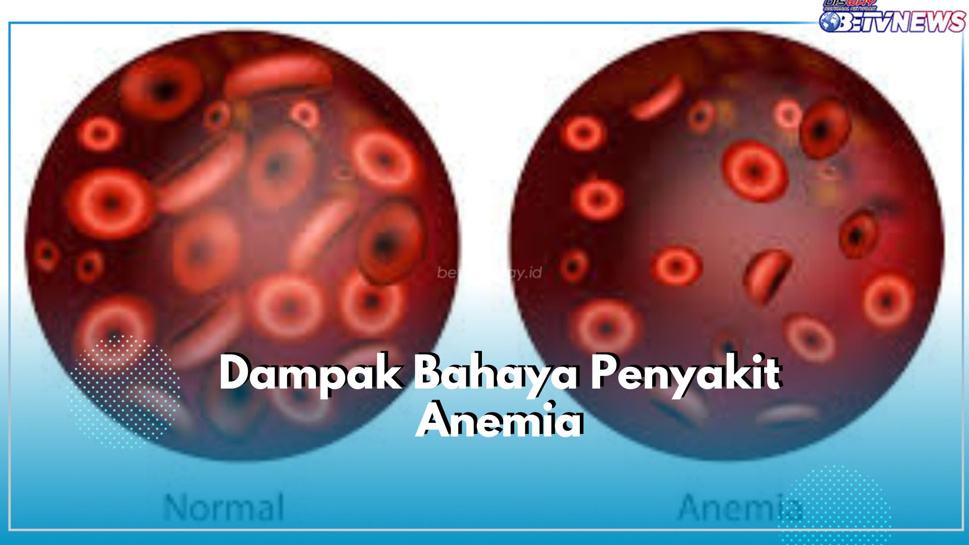 Jangan Anggap Sepele! Inilah 6 Bahaya yang Bisa Dirasakan Tubuh Jika Anemia Dibiarkan Begitu Saja, Cek!