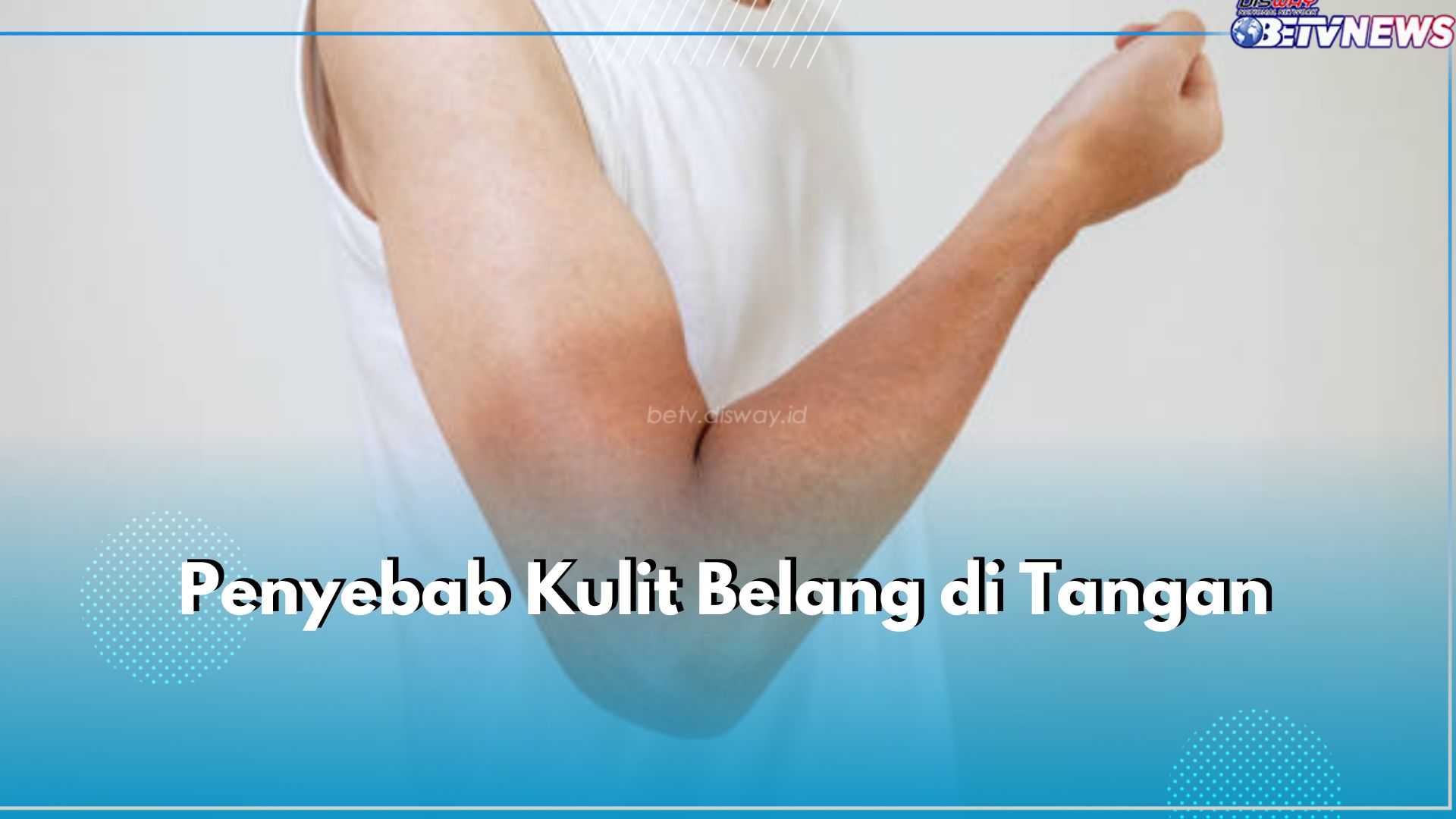 Kenali 5 Penyebab Kulit Belang di Tangan, Tidak Selamanya Karena Sinar Matahari