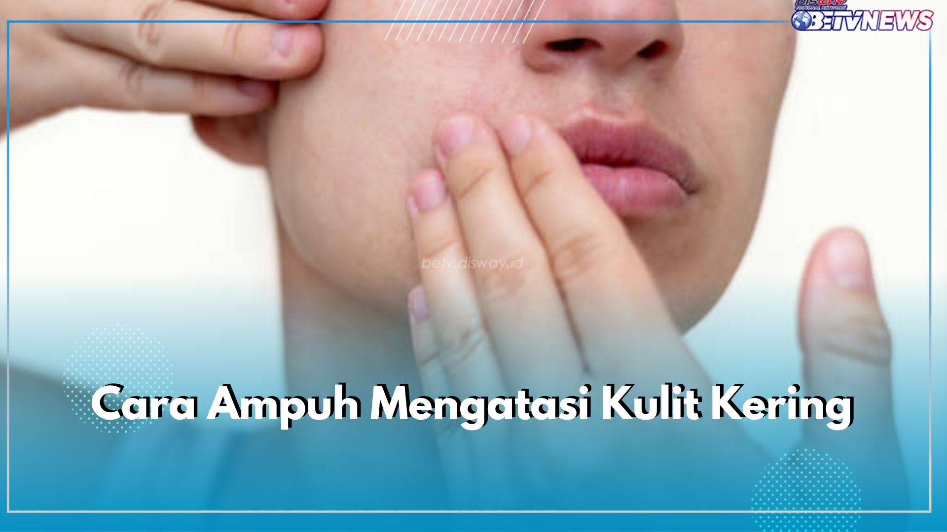 Cara Ampuh Mengatasi Kulit Kering, Pakai Bahan Alami, Ini 5 Rekomendasinya