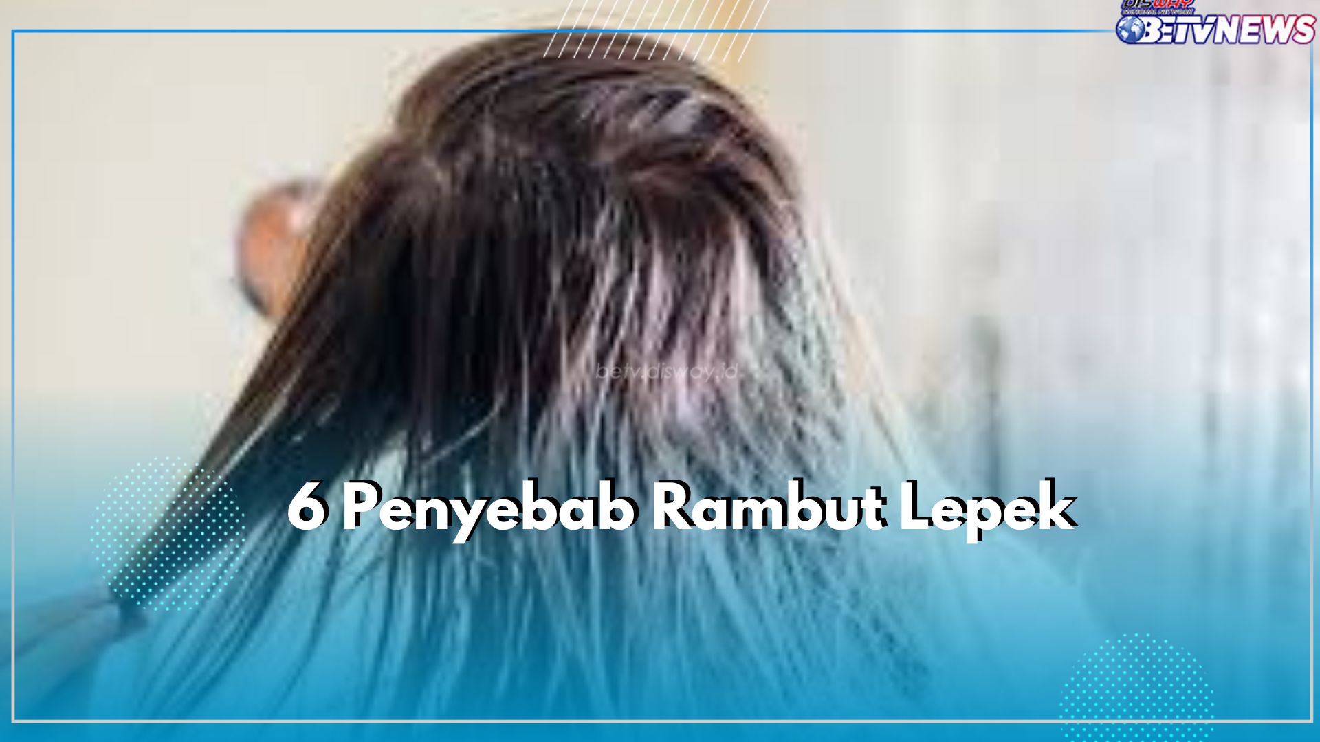 Taukah Kamu? Ternyata Produksi Minyak Berlebih Dikulit Kepala Bisa Memicu Rambut Lepek, Cek Penyebab Lainnya!