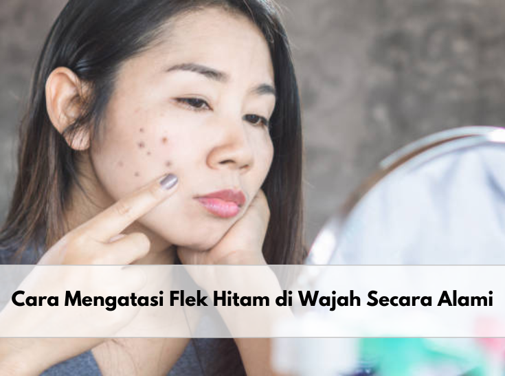 Catat! 5 Bahan Alami Ini Dapat Mengatasi Flek Hitam di Wajah, Salah Satunya Teh Hijau