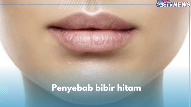 Ini 7 Penyebab Bibir Hitam, Salah Satunya Paparan Sinar UV