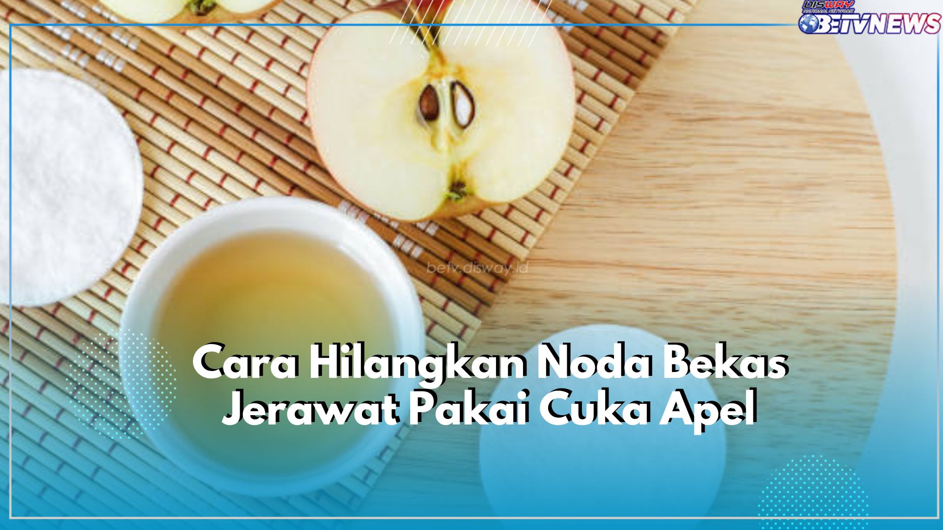 Noda Bekas Jerawat Mengganggu? Yuk Hilangkan dengan Menggunakan Cuka Apel, Klaim Caranya Disini!