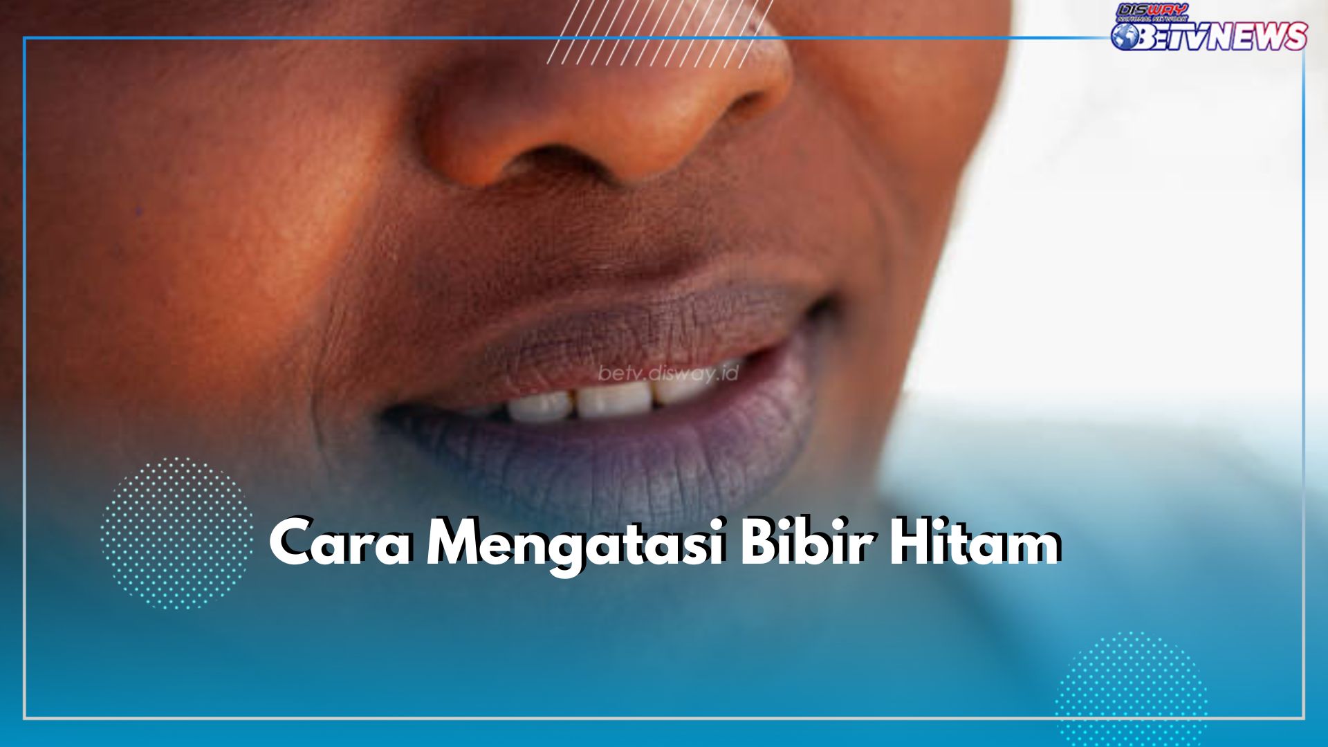 5 Cara Atasi Bibir Hitam Secara Alami, Salah Satunya Kurangi Konsumsi Kafein