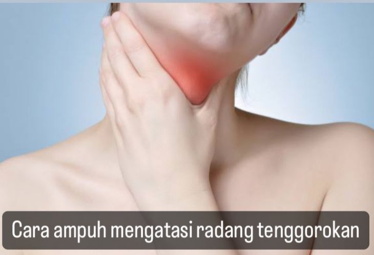 Jangan Diabaikan! Ini 10 Cara Ampuh Mengatasi Radang Tenggorokan, Nomor 4 Belum Banyak yang Tahu, Yuk Cek