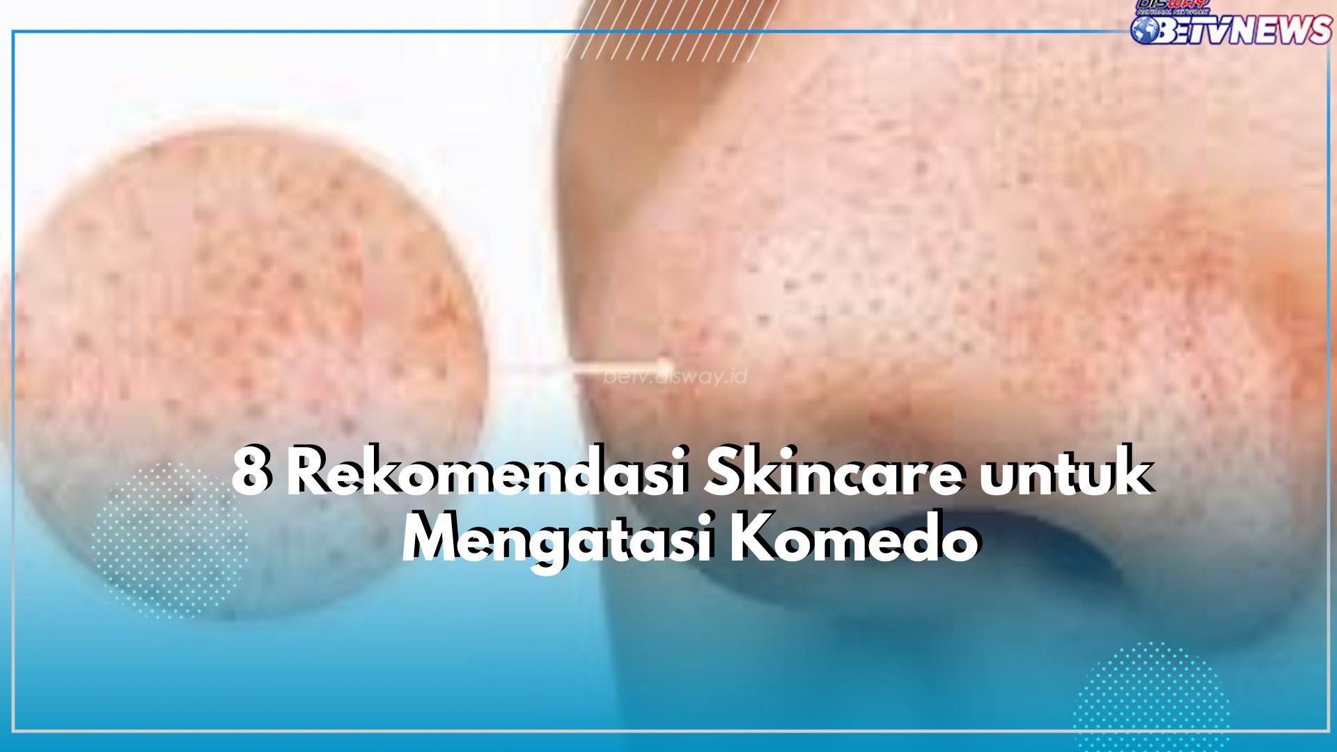 Komedo di Wajah Susah Hilang? Coba Atasi dengan 8 Rekomendasi Produk Skincare Ini, Yuk Tentukan Pilihanmu!