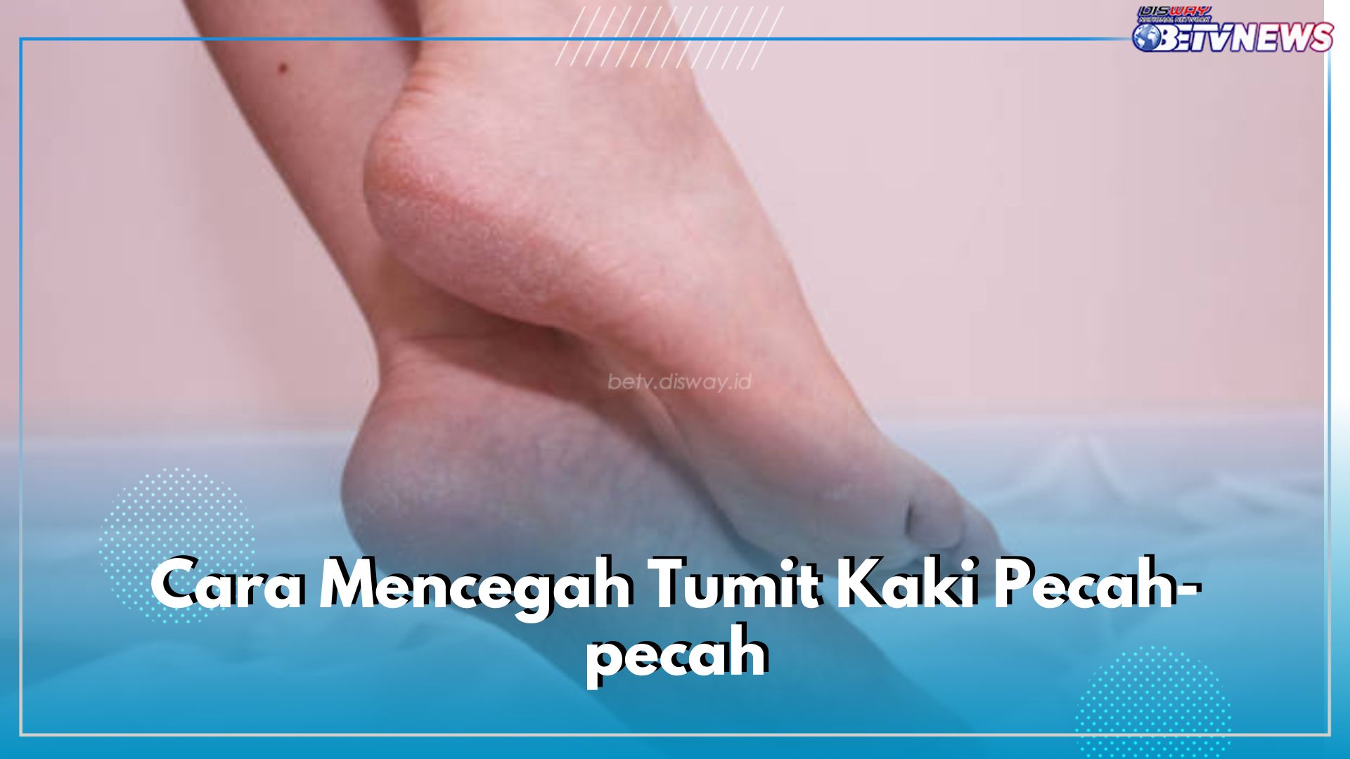 Jaga Agar Tumit Kaki Tetap Mulus dan Anti Pecah-pecah dengan 5 Cara Mudah Ini, Lakukan dari Sekarang!