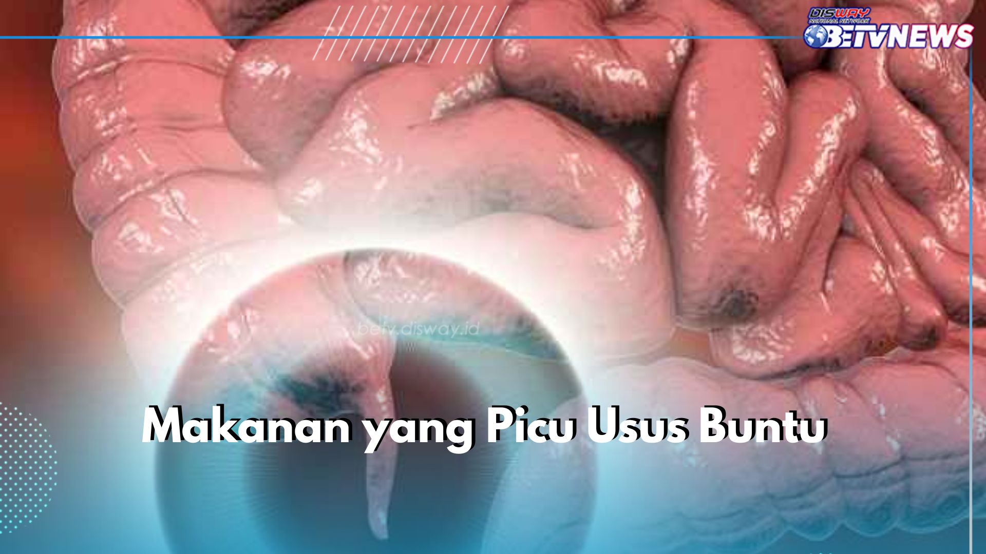 5 Makanan yang Picu Usus Buntu, Produk Olahan Susu Termasuk Salah Satunya